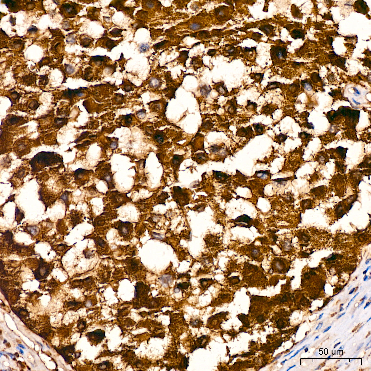S100/S100A1 Rabbit mAb
