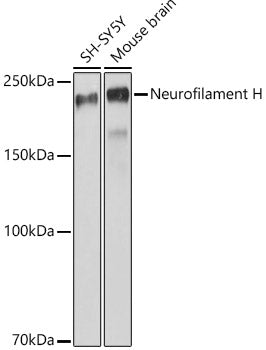 Neurofilament H Rabbit mAb