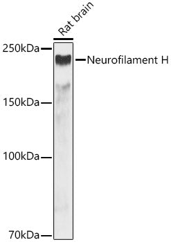 Neurofilament H Rabbit mAb