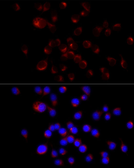 Neurofilament H Rabbit mAb