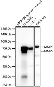 MMP2 Rabbit mAb