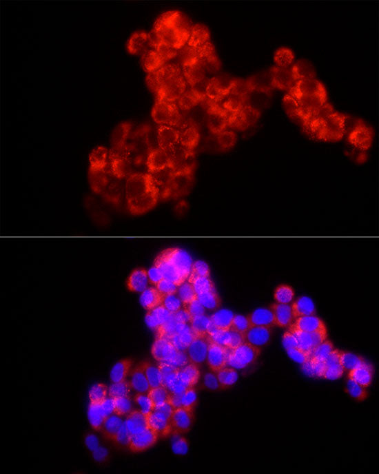 MMP2 Rabbit mAb