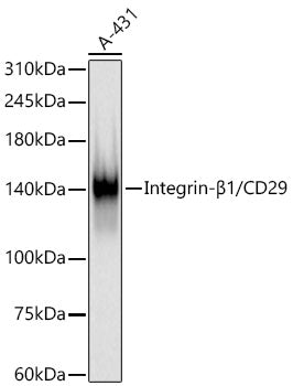 Integrin-β1/CD29 Rabbit mAb
