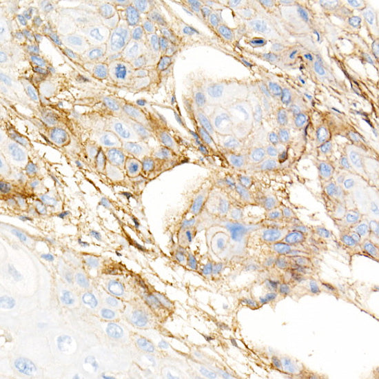 Integrin-β1/CD29 Rabbit mAb