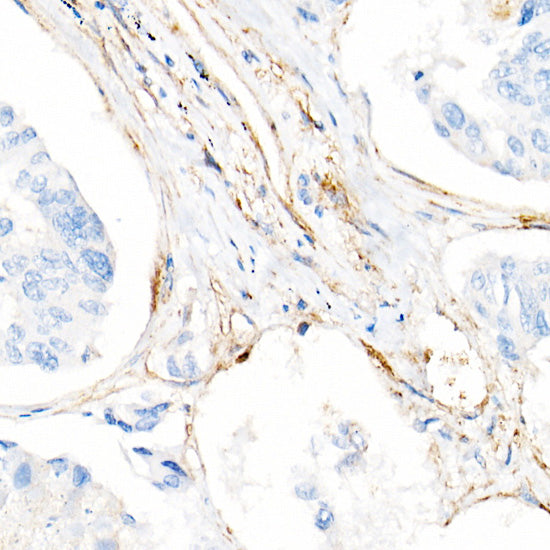 Integrin-β1/CD29 Rabbit mAb