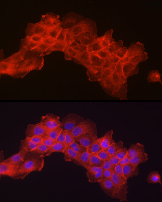 Integrin-β1/CD29 Rabbit mAb