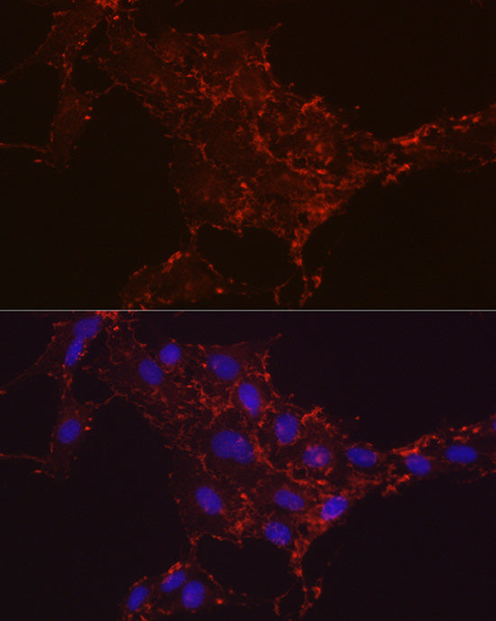 Integrin-β1/CD29 Rabbit mAb