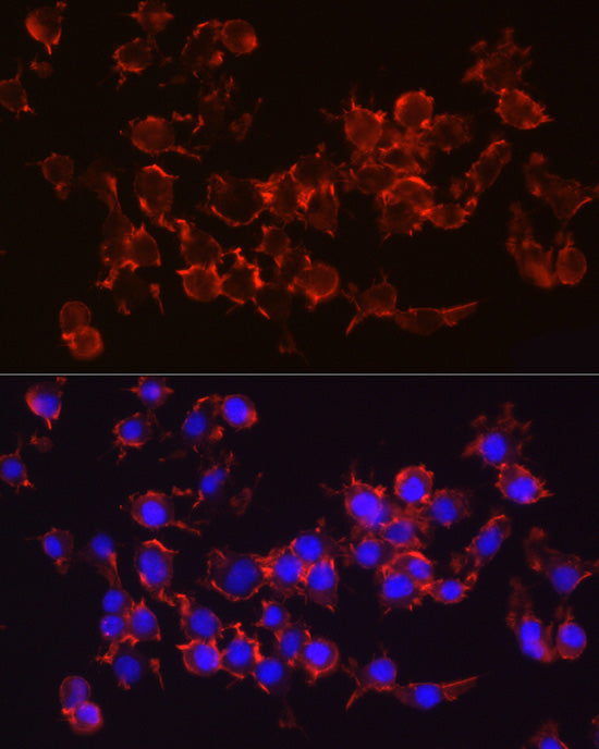 Integrin-β1/CD29 Rabbit mAb