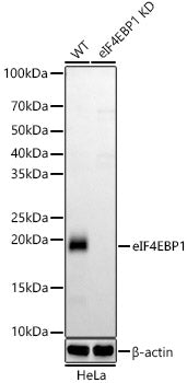 [KD Validated] eIF4EBP1 Rabbit mAb