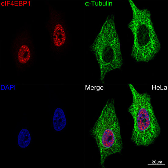 [KD Validated] eIF4EBP1 Rabbit mAb
