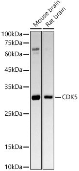 [KO Validated] CDK5 Rabbit mAb