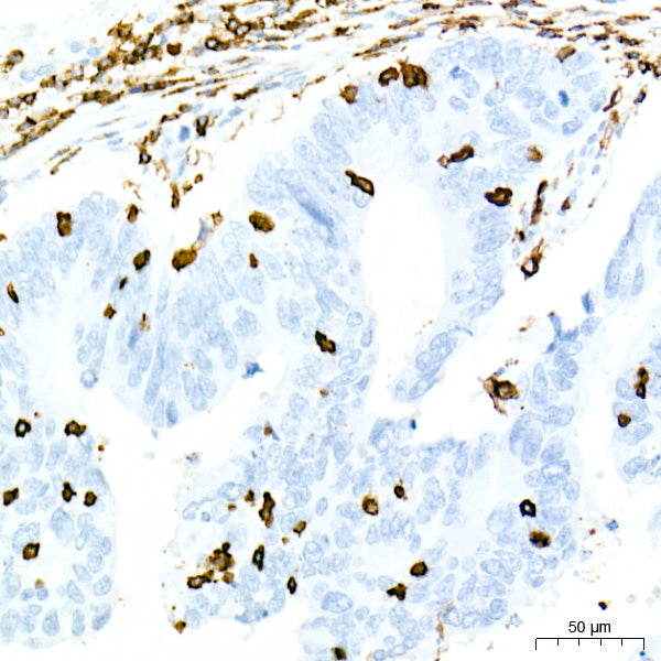 CD45 Rabbit mAb