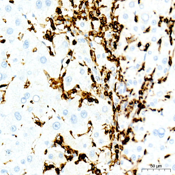 CD45 Rabbit mAb