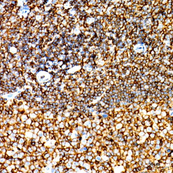 CD45 Rabbit mAb