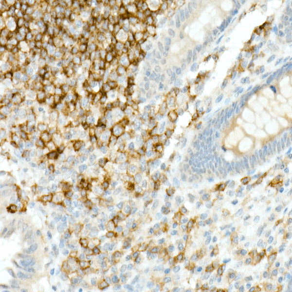 CD19 Rabbit mAb