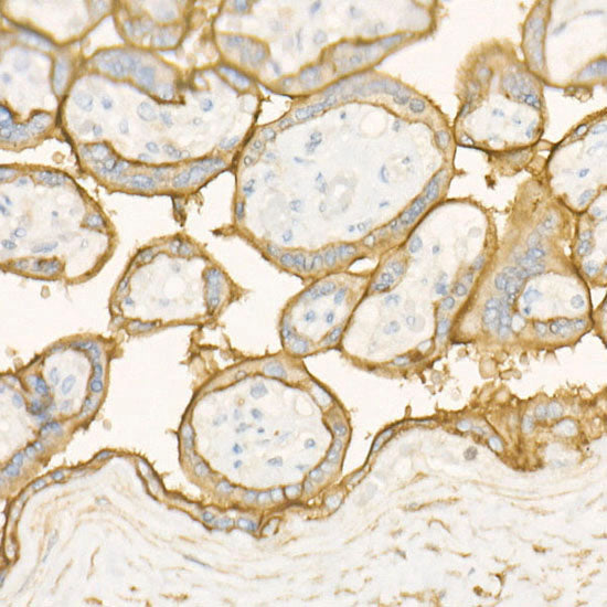 CD10/MME Rabbit mAb