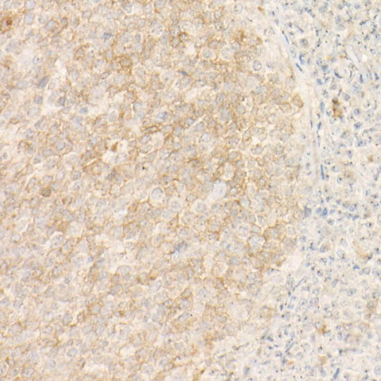 CD10/MME Rabbit mAb