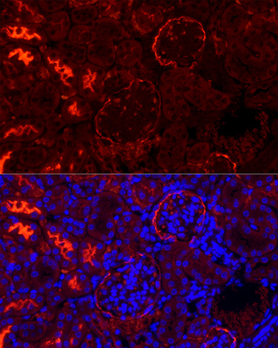 CD10/MME Rabbit mAb