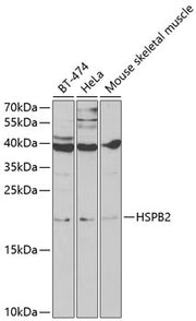 HSPB2 Rabbit pAb
