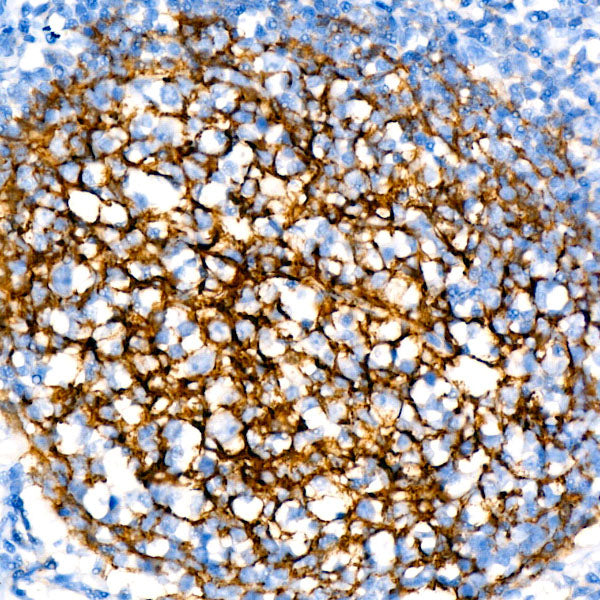 CR2/CD21 Rabbit mAb