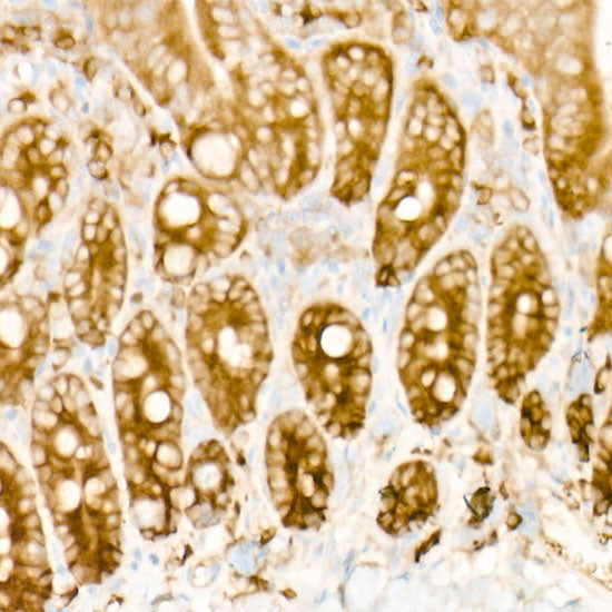eIF4A1 Rabbit mAb