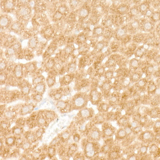 eIF4A1 Rabbit mAb