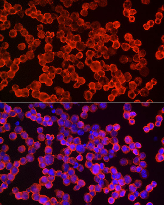 eIF4A1 Rabbit mAb