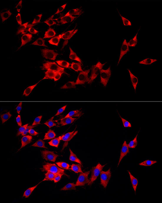 eIF4A1 Rabbit mAb
