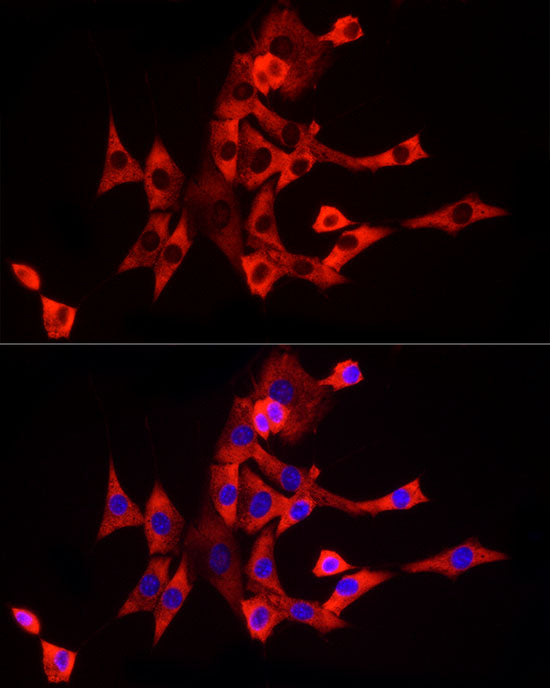 eIF4A1 Rabbit mAb