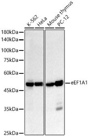 eEF1A1 Rabbit mAb