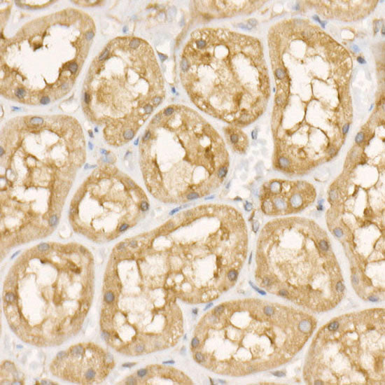 eEF1A1 Rabbit mAb