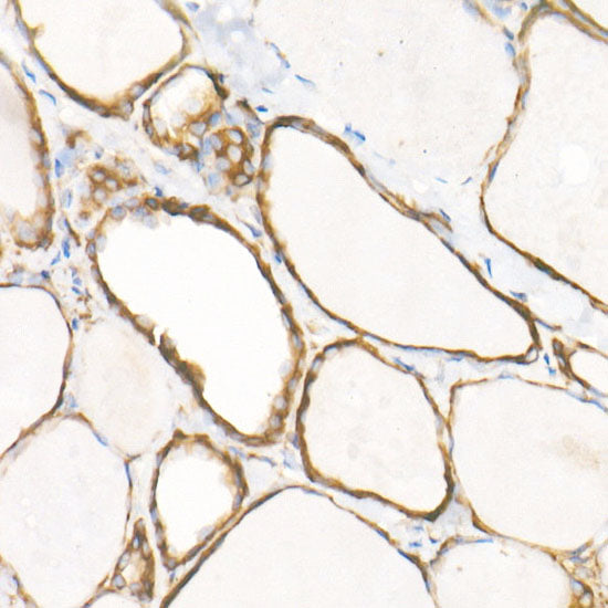 eEF1A1 Rabbit mAb