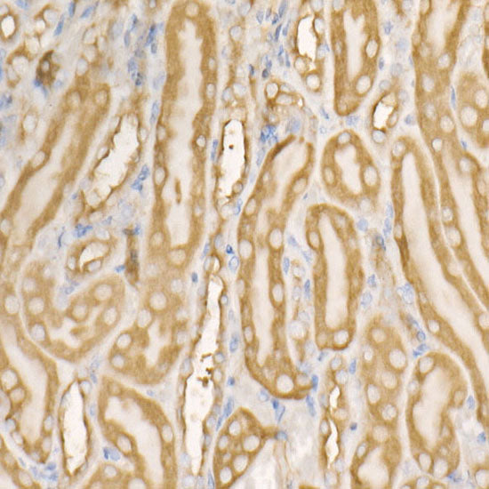 eEF1A1 Rabbit mAb