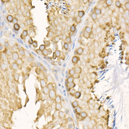 eEF1A1 Rabbit mAb