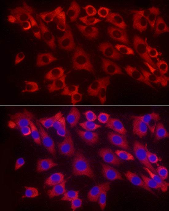 eEF1A1 Rabbit mAb