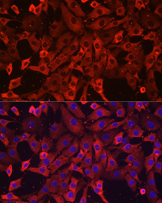 eEF1A1 Rabbit mAb