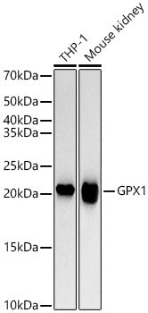 GPX1 Rabbit mAb