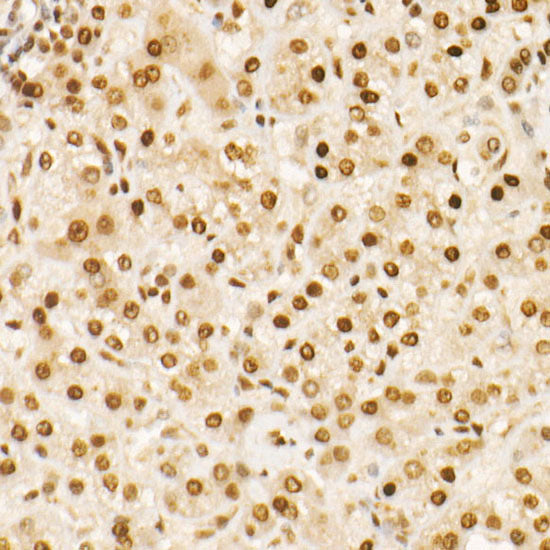 MGMT Rabbit mAb