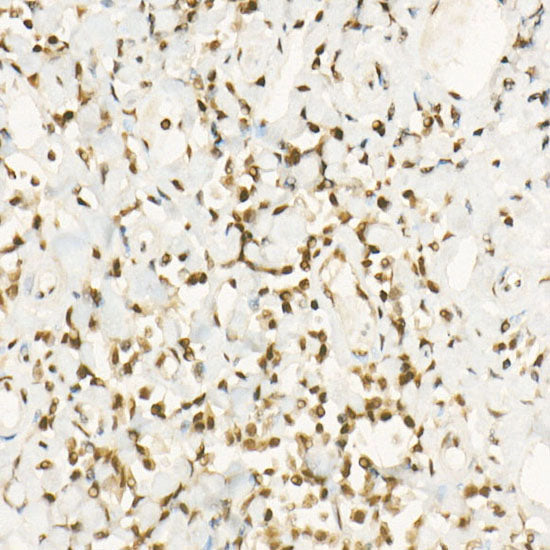 MGMT Rabbit mAb