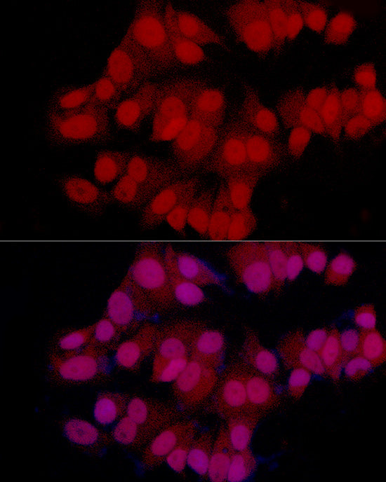 MGMT Rabbit mAb