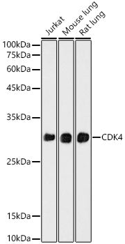 CDK4 Rabbit mAb