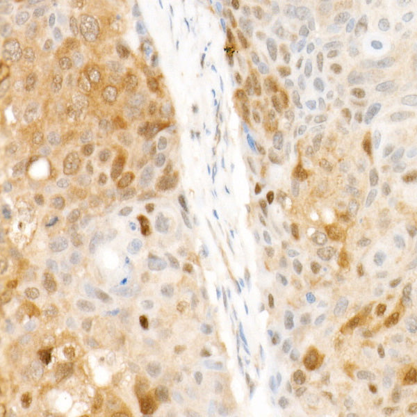 CDK4 Rabbit mAb