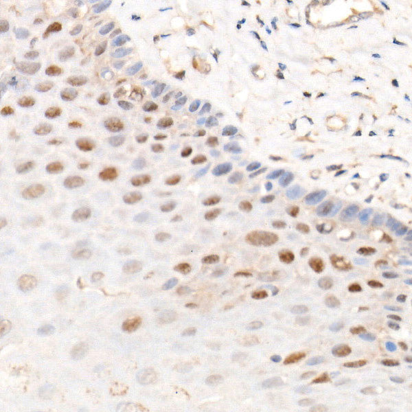 CDK4 Rabbit mAb