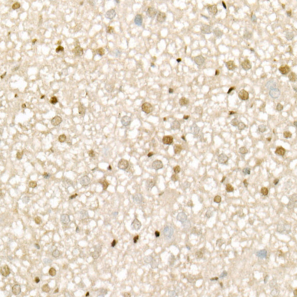 CDK4 Rabbit mAb