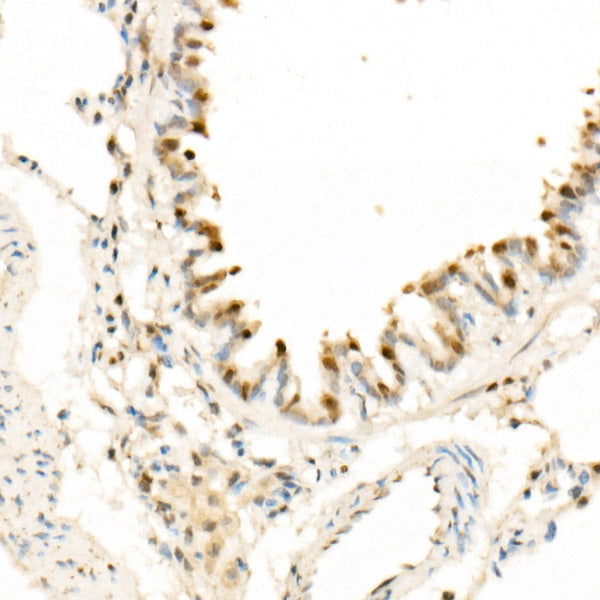 CDK4 Rabbit mAb