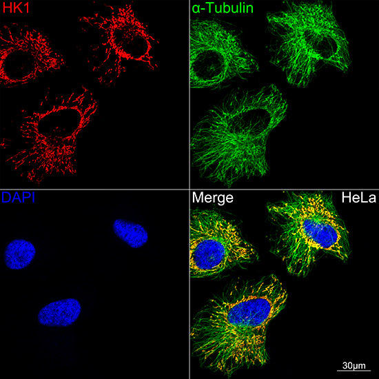 HK1 Rabbit mAb