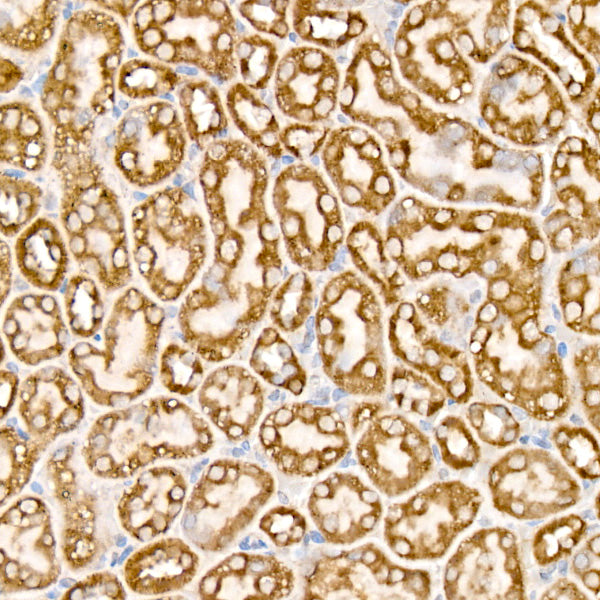Mitofilin Rabbit mAb