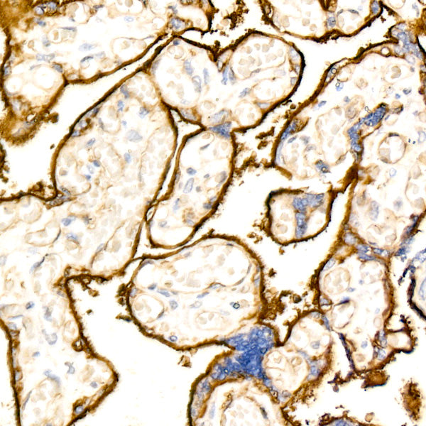 CD200 Rabbit mAb