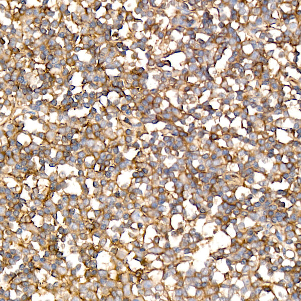 CD200 Rabbit mAb