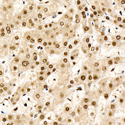 CHD4 Rabbit mAb